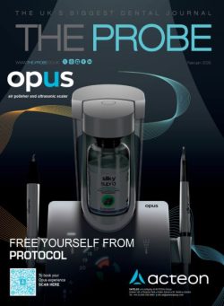 The Probe – February 2026